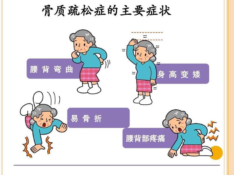 骨质疏松.jpg